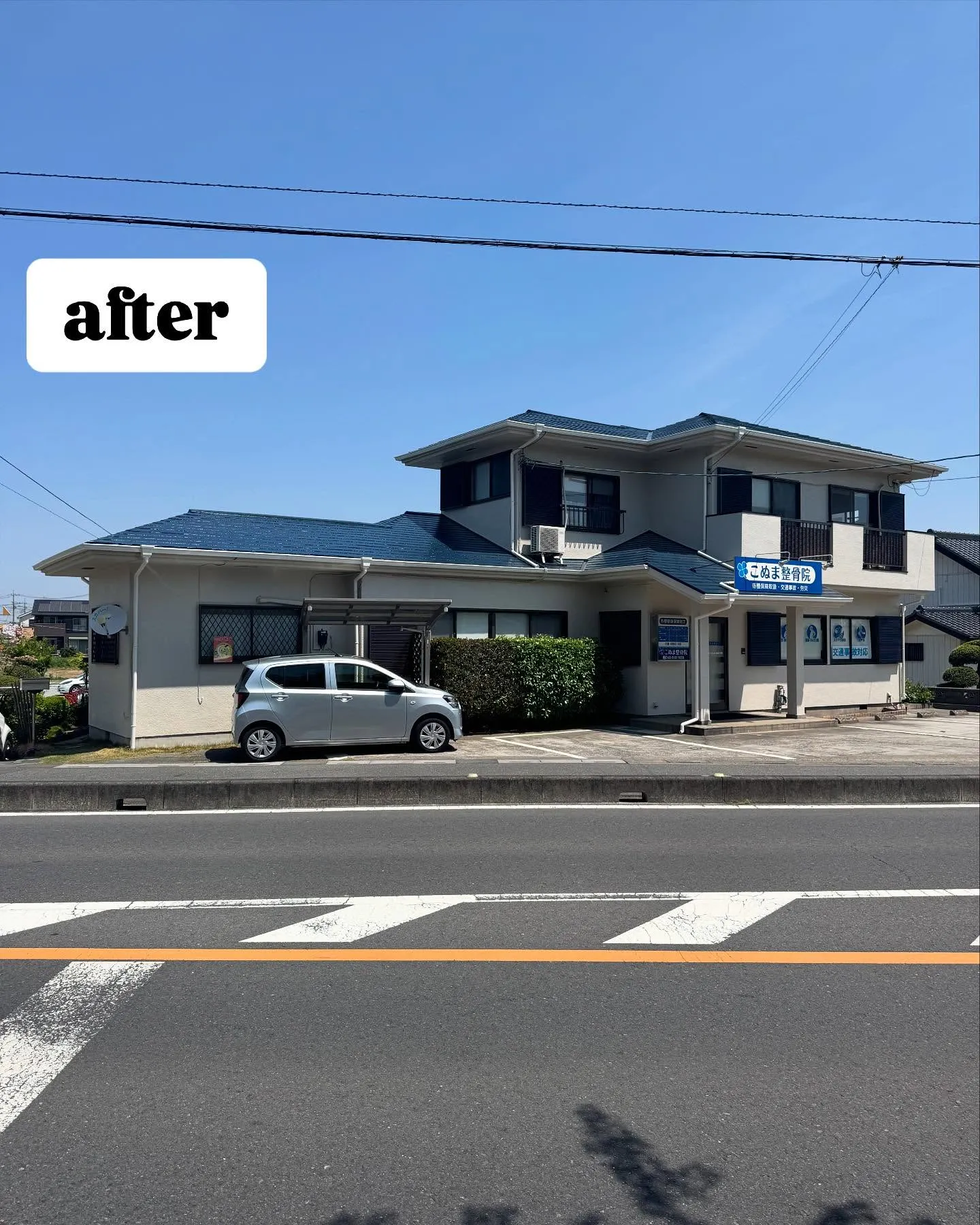 埼玉県鴻巣市にあるこぬま整骨院様の外壁屋根塗装と雨樋交換工事...